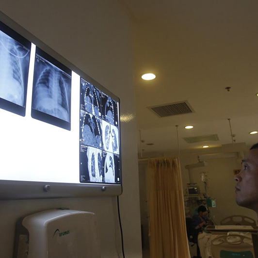 A series of x-ray images on a light wall
