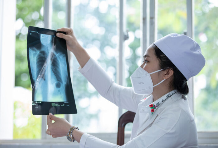 Dr. Phan Thi Kim Thoai reads a chest x-ray film at Tay Ninh Provincial Lung Health Hospital in Viet Nam.